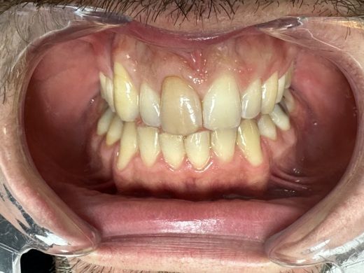 Lanzarote Catamaran Lagoon Lagoon 450f alt tag text